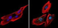 Immunocytochemistry/ Immunofluorescence - Anti-CREB + ICER antibody (AB5803)