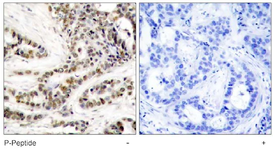 Immunohistochemistry (Formalin/PFA-fixed paraffin-embedded sections) - Anti-CREB (phospho S129) antibody (AB47373)