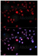 Immunocytochemistry/ Immunofluorescence - Anti-CREB (phospho S133) antibody (AB194687)