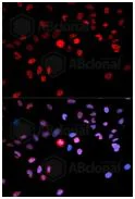 Immunocytochemistry/ Immunofluorescence - Anti-CREB (phospho S133) antibody (AB194687)