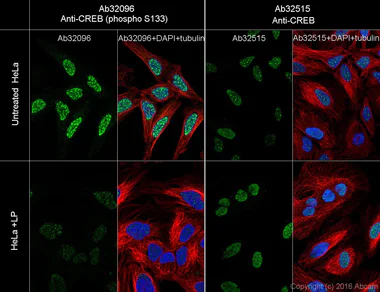 Immunocytochemistry/ Immunofluorescence - Anti-CREB (phospho S133) antibody [E113] (AB32096)