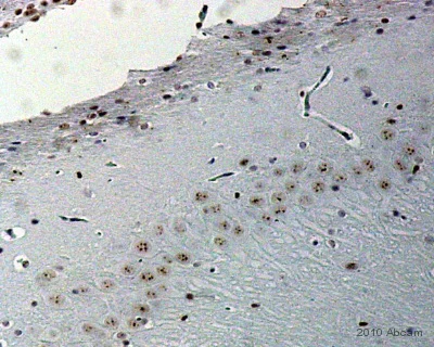 Immunohistochemistry (Formalin/PFA-fixed paraffin-embedded sections) - Anti-CREB (phospho S133) antibody [E113] (AB32096)