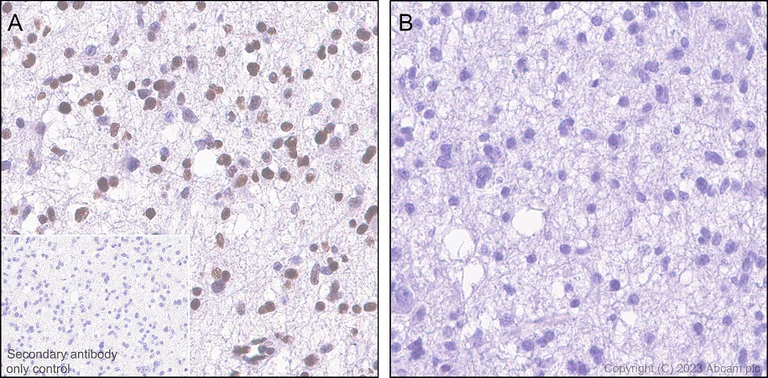 Immunohistochemistry (Formalin/PFA-fixed paraffin-embedded sections) - Anti-CREB (phospho S133) antibody [E113] (AB32096)