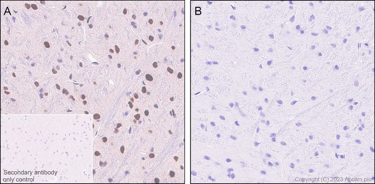 Immunohistochemistry (Formalin/PFA-fixed paraffin-embedded sections) - Anti-CREB (phospho S133) antibody [E113] (AB32096)