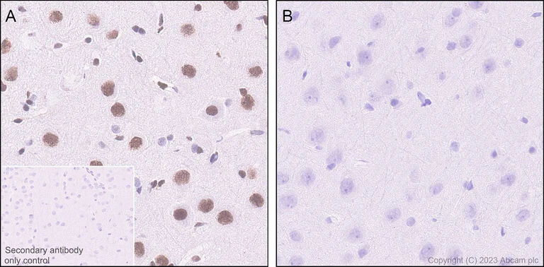 Immunohistochemistry (Formalin/PFA-fixed paraffin-embedded sections) - Anti-CREB (phospho S133) antibody [E113] (AB32096)