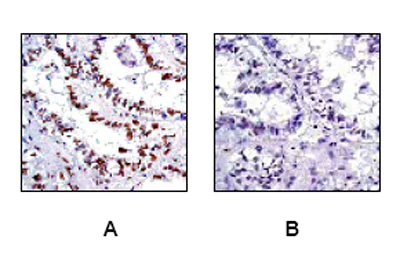 Immunohistochemistry (Formalin/PFA-fixed paraffin-embedded sections) - Anti-CREB (phospho S133) antibody [E113] (AB32096)