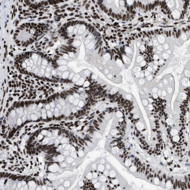 Immunohistochemistry (Formalin/PFA-fixed paraffin-embedded sections) - Anti-CREB1 Antibody (AB327195)