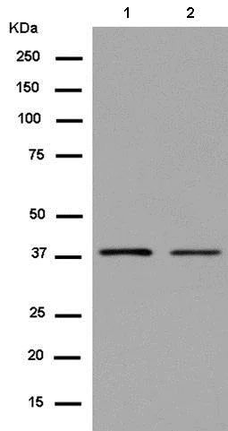 Western blot - Anti-CREB3 antibody [EPR14215(B)] (AB180119)