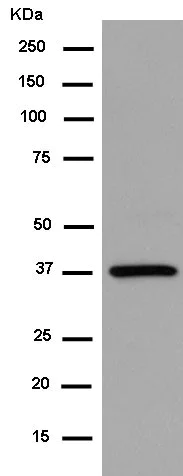 Western blot - Anti-CREB3 antibody [EPR14215(B)] (AB180119)