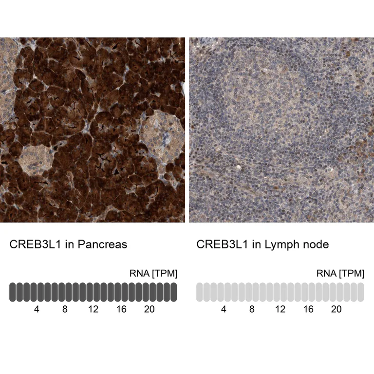 Immunohistochemistry (Formalin/PFA-fixed paraffin-embedded sections) - Anti-CREB3L1 Antibody (AB327203)