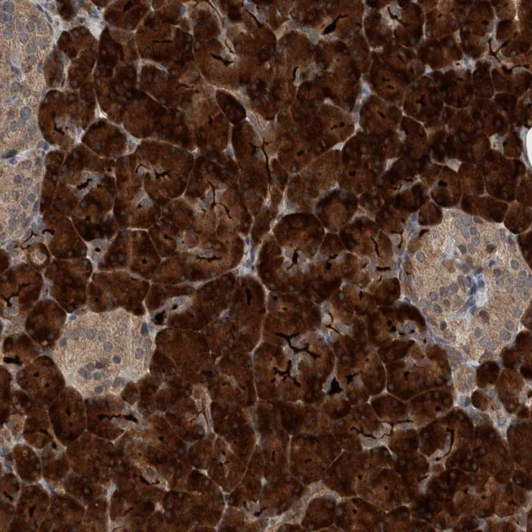 Immunohistochemistry (Formalin/PFA-fixed paraffin-embedded sections) - Anti-CREB3L1 Antibody (AB327203)