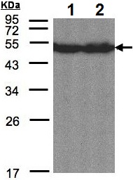 Western blot - Anti-CREB3L1/OASIS antibody (AB137565)