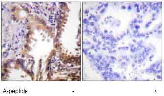 Immunohistochemistry (Formalin/PFA-fixed paraffin-embedded sections) - Anti-CREBBP (acetyl K1535) antibody (AB61242)