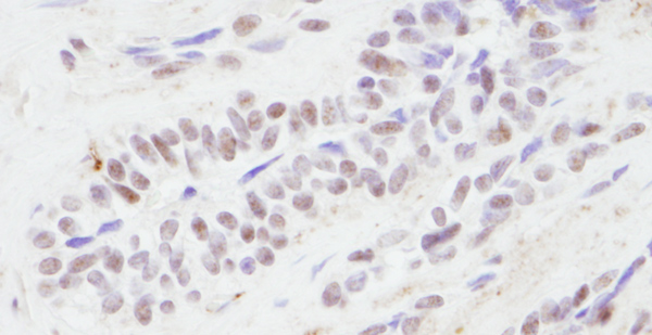 Immunohistochemistry (Formalin/PFA-fixed paraffin-embedded sections) - Anti-CREBBP antibody (AB10490)