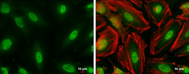 Immunocytochemistry/ Immunofluorescence - Anti-CREBBP antibody (AB137334), expandable thumbnail