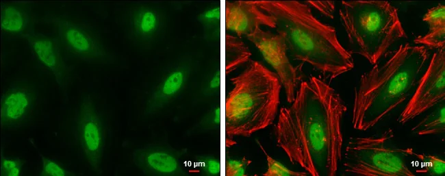 Immunocytochemistry/ Immunofluorescence - Anti-CREBBP antibody (AB137334)
