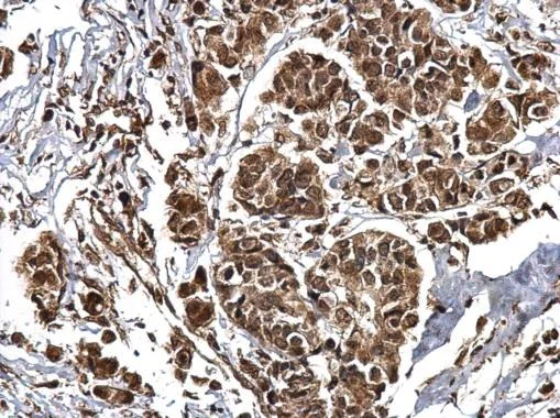 Immunohistochemistry (Formalin/PFA-fixed paraffin-embedded sections) - Anti-CREBBP antibody (AB137334)