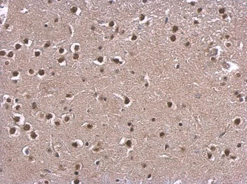 Immunohistochemistry (Formalin/PFA-fixed paraffin-embedded sections) - Anti-CREBBP antibody (AB137334)