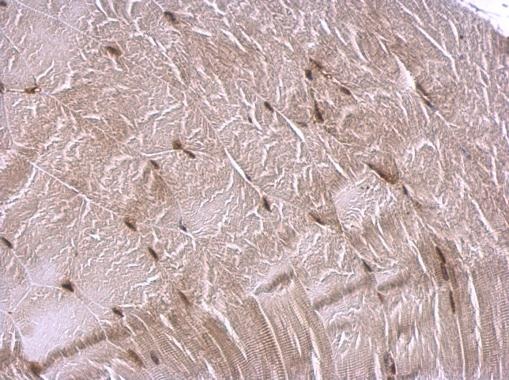 Immunohistochemistry (Formalin/PFA-fixed paraffin-embedded sections) - Anti-CREBBP antibody (AB137334), expandable thumbnail