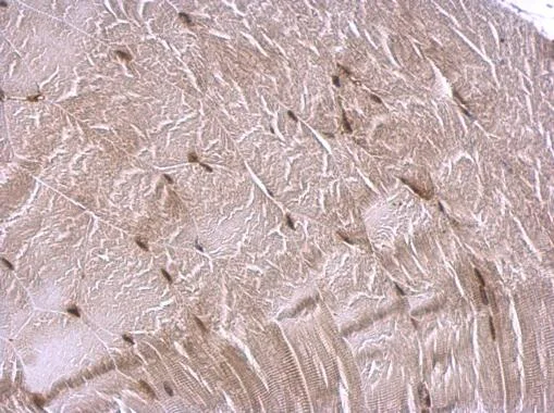 Immunohistochemistry (Formalin/PFA-fixed paraffin-embedded sections) - Anti-CREBBP antibody (AB137334)