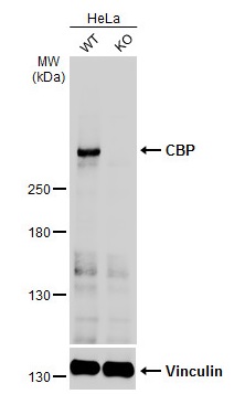 Western blot - Anti-CREBBP antibody (AB137334), expandable thumbnail