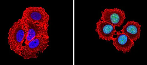 Immunocytochemistry/ Immunofluorescence - Anti-CREBBP antibody (AB2832)