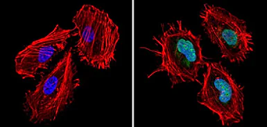 Immunocytochemistry/ Immunofluorescence - Anti-CREBBP antibody (AB2832)