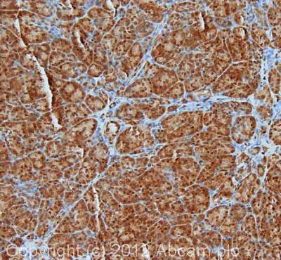 Immunohistochemistry (Formalin/PFA-fixed paraffin-embedded sections) - Anti-CREBBP antibody (AB2832)