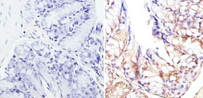 Immunohistochemistry (Formalin/PFA-fixed paraffin-embedded sections) - Anti-CREBBP antibody (AB2832)