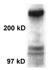 Western blot - Anti-CREBBP antibody (AB2832)