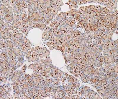 Immunohistochemistry (Formalin/PFA-fixed paraffin-embedded sections) - Anti-CREBBP antibody [CBP5I001] (AB50702)