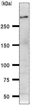Western blot - Anti-CREBBP antibody [CBP5I001] (AB50702)
