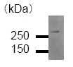 Western blot - Anti-CREBBP antibody [CBP5I001] (AB50702)