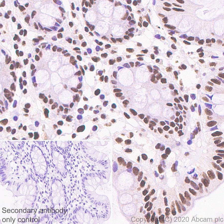 Immunohistochemistry (Formalin/PFA-fixed paraffin-embedded sections) - Anti-CREBBP + KAT3B / p300 antibody [EPR23495-276] (AB275379)