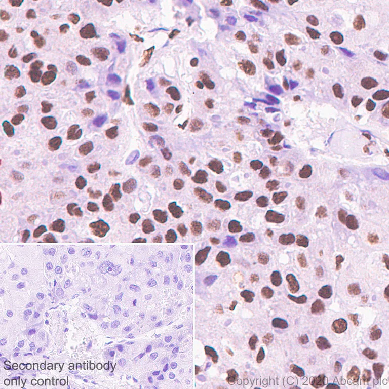 Immunohistochemistry (Formalin/PFA-fixed paraffin-embedded sections) - Anti-CREBBP + KAT3B / p300 antibody [EPR23495-276] - BSA and Azide free (AB275389)