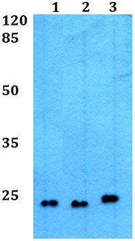Western blot - Anti-CREG1/CREG antibody (AB191909)