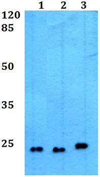 Western blot - Anti-CREG1/CREG antibody (AB191909)