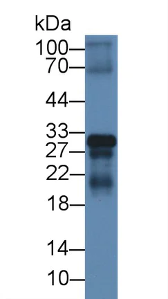 Western blot - Anti-CREG1/CREG antibody (AB233282)