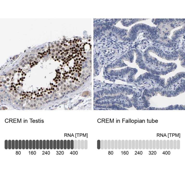 Immunohistochemistry (Formalin/PFA-fixed paraffin-embedded sections) - Anti-CREM Antibody (AB327171)