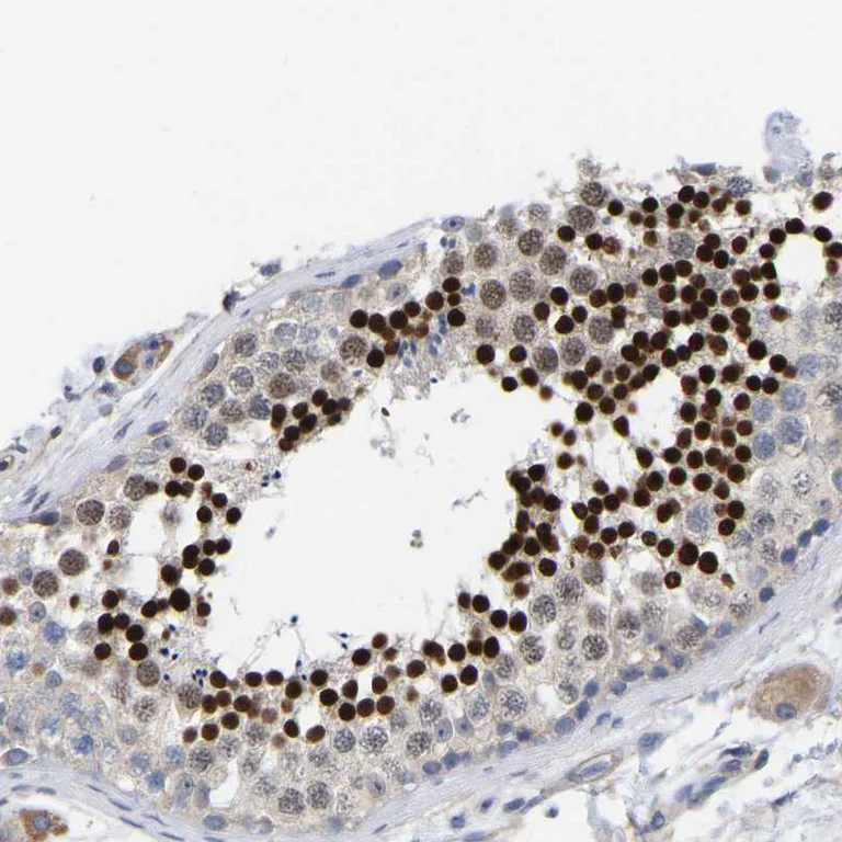 Immunohistochemistry (Formalin/PFA-fixed paraffin-embedded sections) - Anti-CREM Antibody (AB327171)
