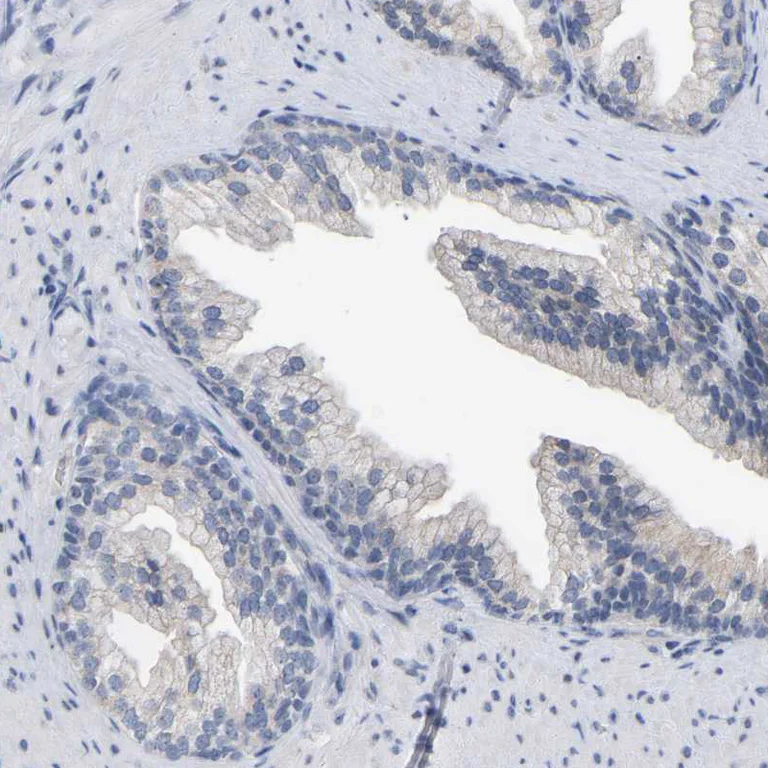 Immunohistochemistry (Formalin/PFA-fixed paraffin-embedded sections) - Anti-CREM Antibody (AB327171)