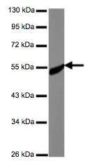 Western blot - Anti-CREST antibody (AB126126)