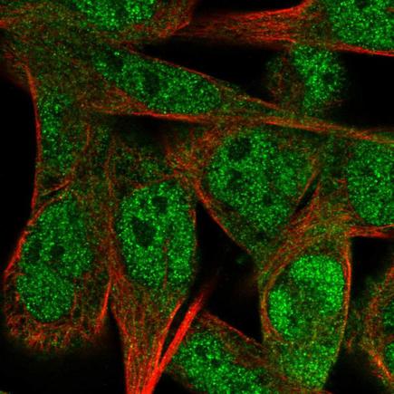 Immunocytochemistry/ Immunofluorescence - Anti-CREST antibody (AB222312)