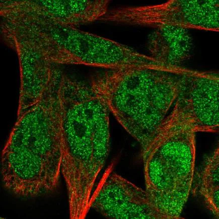Immunocytochemistry/ Immunofluorescence - Anti-CREST antibody (AB222312)