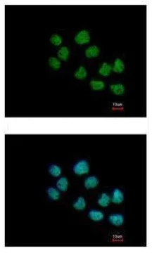 Immunocytochemistry/ Immunofluorescence - Anti-CREST antibody (AB227535)