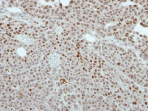 Immunohistochemistry (Formalin/PFA-fixed paraffin-embedded sections) - Anti-CREST antibody (AB227535)