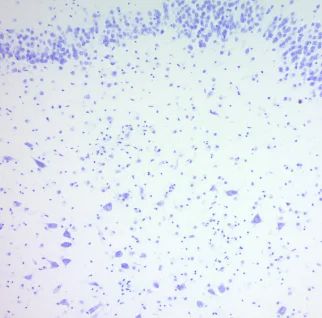 クレシルバイオレット染色液（0.1%）の製品イメージ