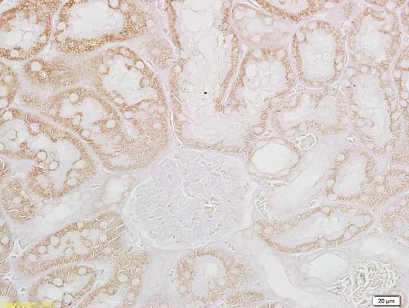 Immunohistochemistry (Formalin/PFA-fixed paraffin-embedded sections) - Anti-CRF antibody (AB216599)