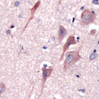 Immunohistochemistry (Formalin/PFA-fixed paraffin-embedded sections) - Anti-CRF antibody - C-terminal (AB231443)