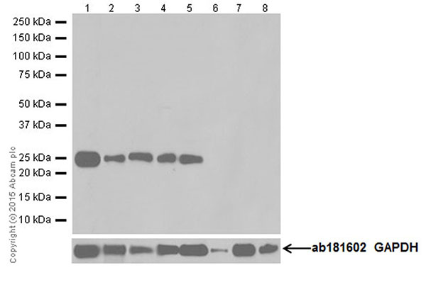 Western blot - Anti-CRF antibody [EPR19154] (AB184238), expandable thumbnail